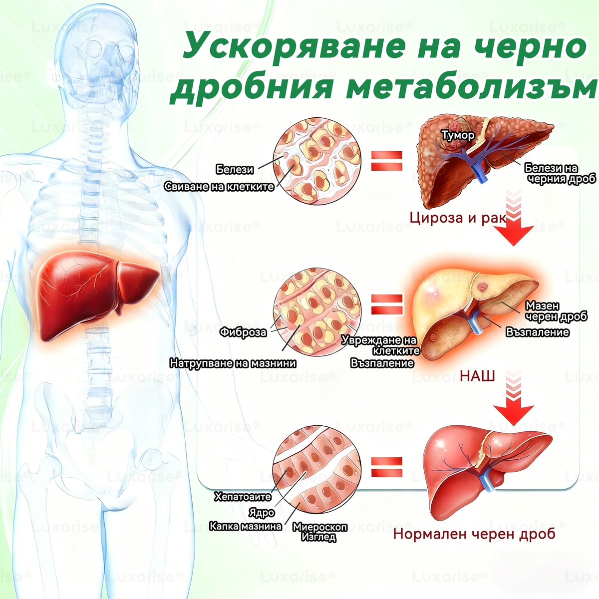 Официален магазин | ✨✨𝗟𝘂𝘅𝗮𝗿𝗶𝘀𝗲® МОРИНГА Х БЕРБЕРИН 10-IN-1 Напреднал Нано Микроигли Пластир (Веднъж дневно, видими резултати след 7 дни) ✅ Подходящ при: затлъстяване, диабет, сънна апнея и проблеми със ставите 💎